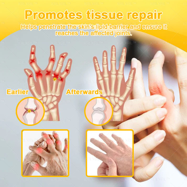 XRLXRL® Bee Venom Pain-Relief Bone Healing Cream🐝🐝(Specially for older adults)