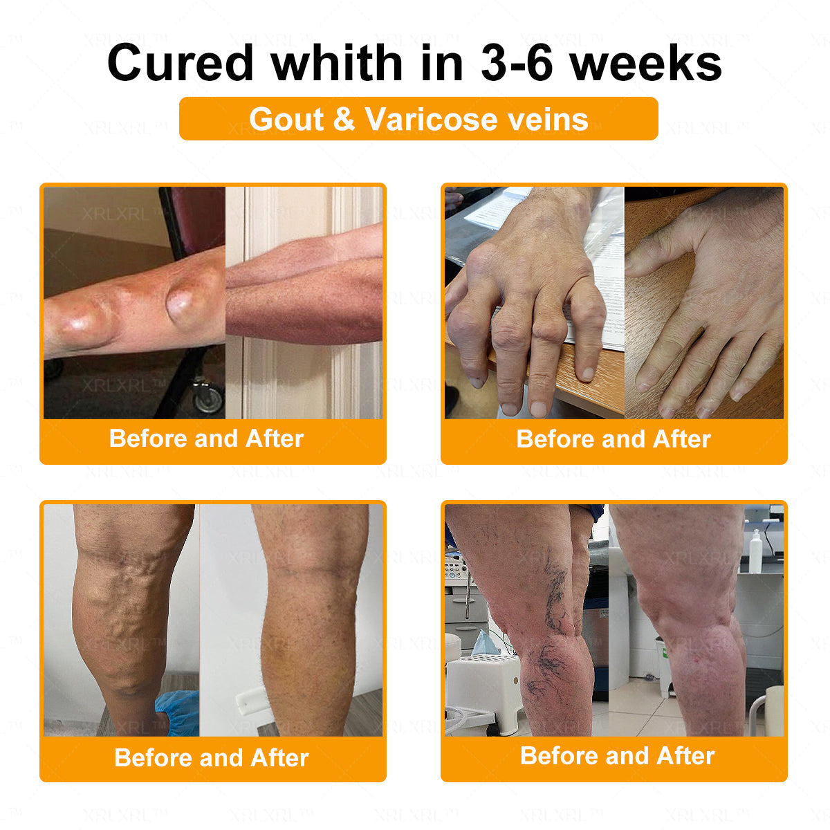 XRLXRL® Bee Venom Pain-Relief Bone Healing Cream🐝🐝(Specially for older adults)