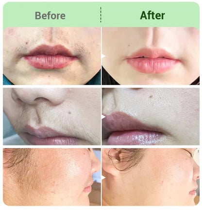 Hair RemovalCream for All Women &Men