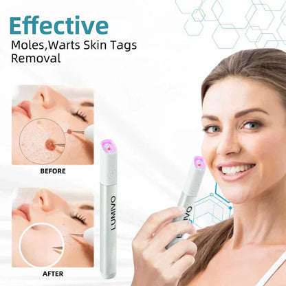 LUMIVO™ All-in-One CO₂ Laser Eraser Pen | Removes Moles, Warts, Skin Flaws & Pigmentation