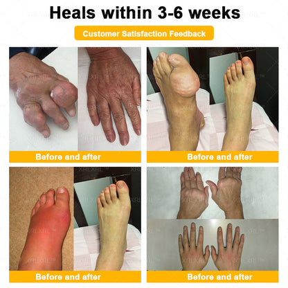 XRLXRL® Bee Venom Pain-Relief Bone Healing Cream🐝🐝(Specially for older adults)