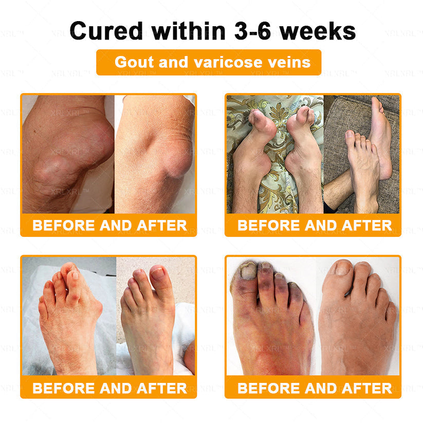 XRLXRL® Bee Venom Pain-Relief Bone Healing Cream🐝🐝(Specially for older adults)
