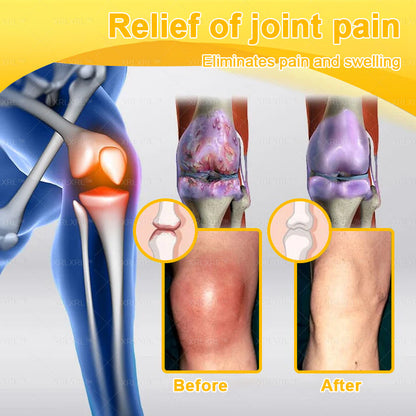 XRLXRL® Bee Venom Pain-Relief Bone Healing Cream🐝🐝(Specially for older adults)