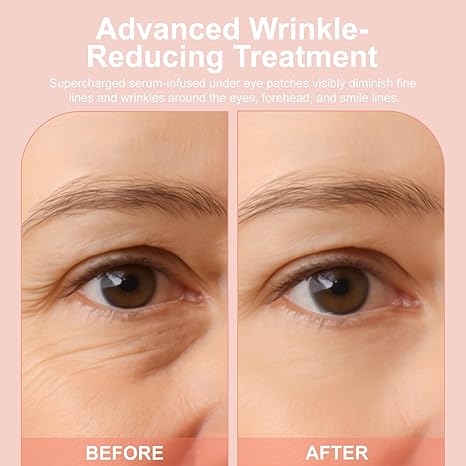 👁️ WAKE UP LOOKING YEARS YOUNGER Hyaluronic Acid Microneedle Eye Mask