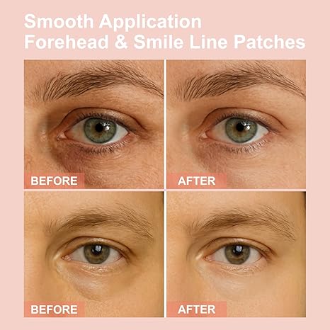 👁️ WAKE UP LOOKING YEARS YOUNGER Hyaluronic Acid Microneedle Eye Mask