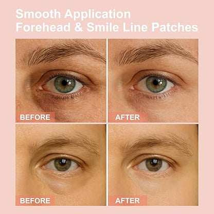 👁️ WAKE UP LOOKING YEARS YOUNGER Hyaluronic Acid Microneedle Eye Mask