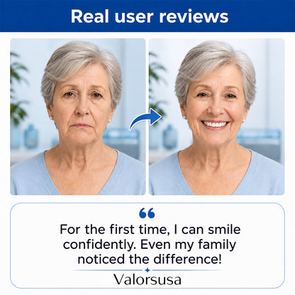 Custom-Fit Dentures for Everyday Comfort