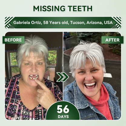 Your Smile~Bodylure® 🦷 Tideglusib Fast‑Dissolving Tooth & Gum Repair Oral Strips ✨ (𝟓-𝐢𝐧-𝟏 💎 𝐑𝐞𝐛𝐮𝐢𝐥𝐝 𝐄𝐧𝐚𝐦𝐞𝐥 & 𝐃𝐞𝐧𝐭𝐢𝐧 • 𝐒𝐭𝐫𝐞𝐧𝐠𝐭𝐡𝐞𝐧 𝐆𝐮𝐦𝐬 • 𝐄𝐫𝐚𝐝𝐢𝐜𝐚𝐭𝐞 𝐓𝐚𝐫𝐭𝐚𝐫 & 𝐎𝐝𝐨𝐫 • 𝐖𝐡𝐢𝐭𝐞𝐧𝐢𝐧𝐠 • 𝐒𝐭𝐨𝐩 𝐓𝐨𝐨𝐭𝐡 𝐒𝐞𝐧𝐬𝐢𝐭𝐢𝐯𝐢𝐭𝐲)