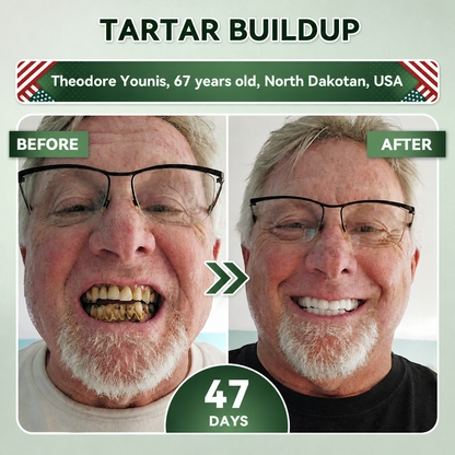 Your Smile~Bodylure® 🦷 Tideglusib Fast‑Dissolving Tooth & Gum Repair Oral Strips ✨ (𝟓-𝐢𝐧-𝟏 💎 𝐑𝐞𝐛𝐮𝐢𝐥𝐝 𝐄𝐧𝐚𝐦𝐞𝐥 & 𝐃𝐞𝐧𝐭𝐢𝐧 • 𝐒𝐭𝐫𝐞𝐧𝐠𝐭𝐡𝐞𝐧 𝐆𝐮𝐦𝐬 • 𝐄𝐫𝐚𝐝𝐢𝐜𝐚𝐭𝐞 𝐓𝐚𝐫𝐭𝐚𝐫 & 𝐎𝐝𝐨𝐫 • 𝐖𝐡𝐢𝐭𝐞𝐧𝐢𝐧𝐠 • 𝐒𝐭𝐨𝐩 𝐓𝐨𝐨𝐭𝐡 𝐒𝐞𝐧𝐬𝐢𝐭𝐢𝐯𝐢𝐭𝐲)
