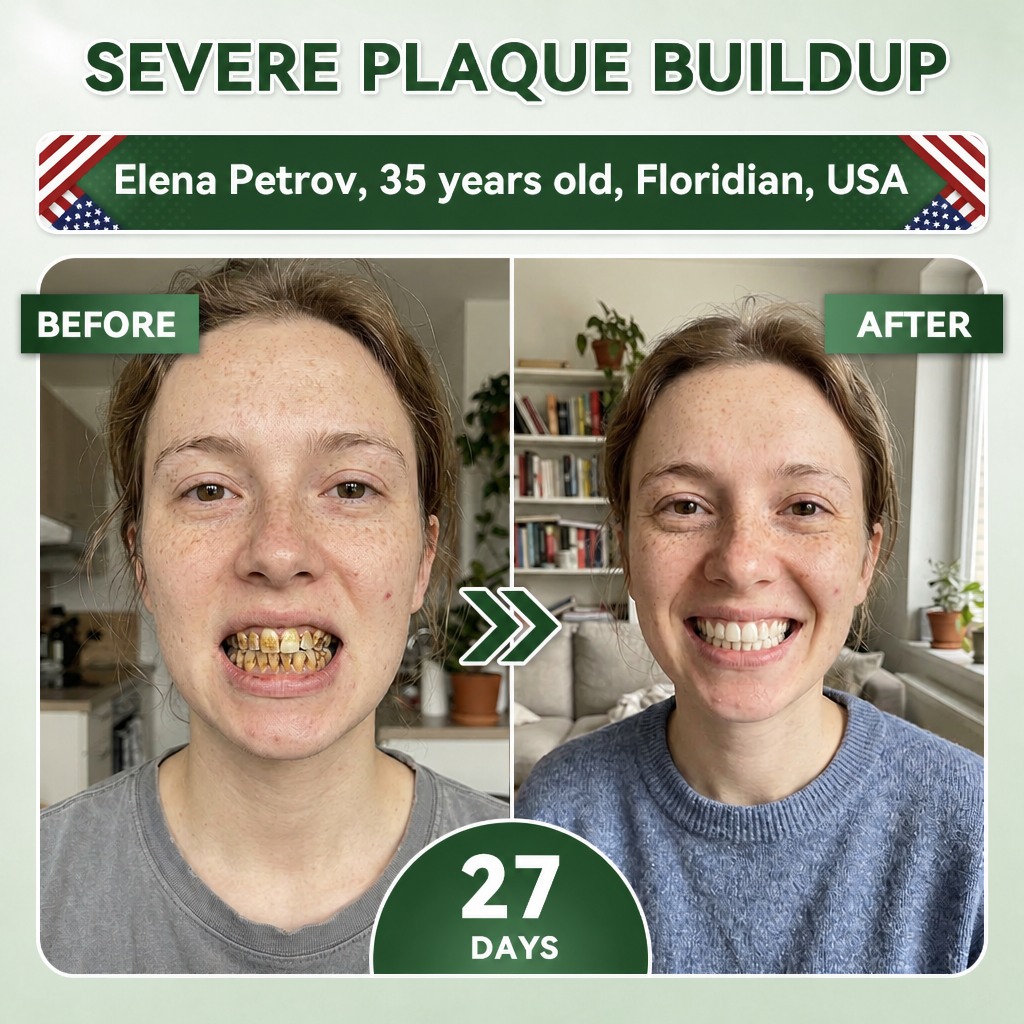 Your Smile~Bodylure® 🦷 Tideglusib Fast‑Dissolving Tooth & Gum Repair Oral Strips ✨ (𝟓-𝐢𝐧-𝟏 💎 𝐑𝐞𝐛𝐮𝐢𝐥𝐝 𝐄𝐧𝐚𝐦𝐞𝐥 & 𝐃𝐞𝐧𝐭𝐢𝐧 • 𝐒𝐭𝐫𝐞𝐧𝐠𝐭𝐡𝐞𝐧 𝐆𝐮𝐦𝐬 • 𝐄𝐫𝐚𝐝𝐢𝐜𝐚𝐭𝐞 𝐓𝐚𝐫𝐭𝐚𝐫 & 𝐎𝐝𝐨𝐫 • 𝐖𝐡𝐢𝐭𝐞𝐧𝐢𝐧𝐠 • 𝐒𝐭𝐨𝐩 𝐓𝐨𝐨𝐭𝐡 𝐒𝐞𝐧𝐬𝐢𝐭𝐢𝐯𝐢𝐭𝐲)