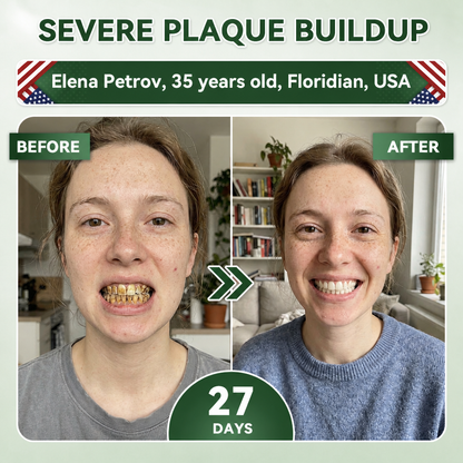 Your Smile~Bodylure® 🦷 Tideglusib Fast‑Dissolving Tooth & Gum Repair Oral Strips ✨ (𝟓-𝐢𝐧-𝟏 💎 𝐑𝐞𝐛𝐮𝐢𝐥𝐝 𝐄𝐧𝐚𝐦𝐞𝐥 & 𝐃𝐞𝐧𝐭𝐢𝐧 • 𝐒𝐭𝐫𝐞𝐧𝐠𝐭𝐡𝐞𝐧 𝐆𝐮𝐦𝐬 • 𝐄𝐫𝐚𝐝𝐢𝐜𝐚𝐭𝐞 𝐓𝐚𝐫𝐭𝐚𝐫 & 𝐎𝐝𝐨𝐫 • 𝐖𝐡𝐢𝐭𝐞𝐧𝐢𝐧𝐠 • 𝐒𝐭𝐨𝐩 𝐓𝐨𝐨𝐭𝐡 𝐒𝐞𝐧𝐬𝐢𝐭𝐢𝐯𝐢𝐭𝐲)