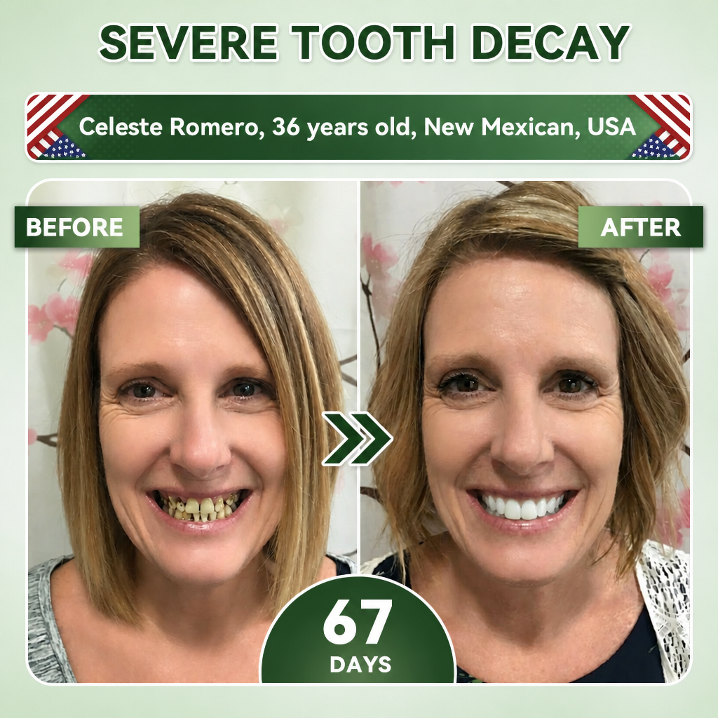 Your Smile~Bodylure® 🦷 Tideglusib Fast‑Dissolving Tooth & Gum Repair Oral Strips ✨ (𝟓-𝐢𝐧-𝟏 💎 𝐑𝐞𝐛𝐮𝐢𝐥𝐝 𝐄𝐧𝐚𝐦𝐞𝐥 & 𝐃𝐞𝐧𝐭𝐢𝐧 • 𝐒𝐭𝐫𝐞𝐧𝐠𝐭𝐡𝐞𝐧 𝐆𝐮𝐦𝐬 • 𝐄𝐫𝐚𝐝𝐢𝐜𝐚𝐭𝐞 𝐓𝐚𝐫𝐭𝐚𝐫 & 𝐎𝐝𝐨𝐫 • 𝐖𝐡𝐢𝐭𝐞𝐧𝐢𝐧𝐠 • 𝐒𝐭𝐨𝐩 𝐓𝐨𝐨𝐭𝐡 𝐒𝐞𝐧𝐬𝐢𝐭𝐢𝐯𝐢𝐭𝐲)