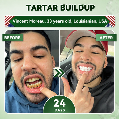 Your Smile~Bodylure® 🦷 Tideglusib Fast‑Dissolving Tooth & Gum Repair Oral Strips ✨ (𝟓-𝐢𝐧-𝟏 💎 𝐑𝐞𝐛𝐮𝐢𝐥𝐝 𝐄𝐧𝐚𝐦𝐞𝐥 & 𝐃𝐞𝐧𝐭𝐢𝐧 • 𝐒𝐭𝐫𝐞𝐧𝐠𝐭𝐡𝐞𝐧 𝐆𝐮𝐦𝐬 • 𝐄𝐫𝐚𝐝𝐢𝐜𝐚𝐭𝐞 𝐓𝐚𝐫𝐭𝐚𝐫 & 𝐎𝐝𝐨𝐫 • 𝐖𝐡𝐢𝐭𝐞𝐧𝐢𝐧𝐠 • 𝐒𝐭𝐨𝐩 𝐓𝐨𝐨𝐭𝐡 𝐒𝐞𝐧𝐬𝐢𝐭𝐢𝐯𝐢𝐭𝐲)